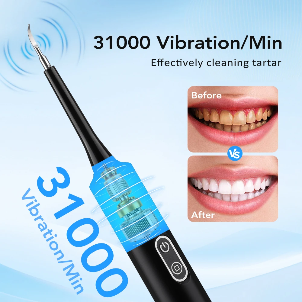 Elektrischer Schallvibrations- – Teeth Whitening Mouthwash Bewertung und Preis